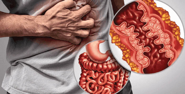 Zkušenosti zákazníka s Crohnovou chorobou a jak mu Kratom pomohl vrátit život